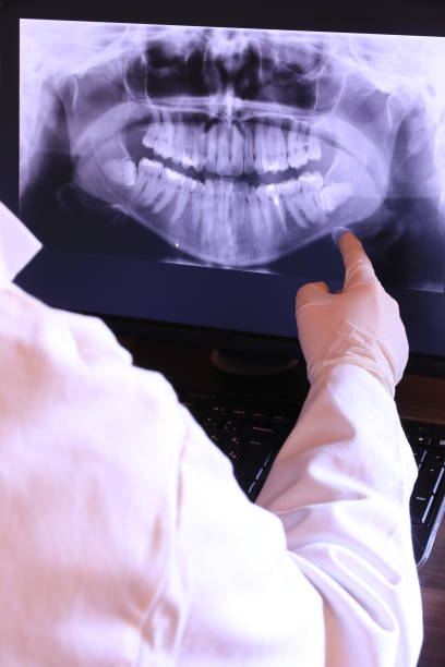 Best Knocked-Out Tooth (Avulsed Tooth) Treatment in Hayden, AL