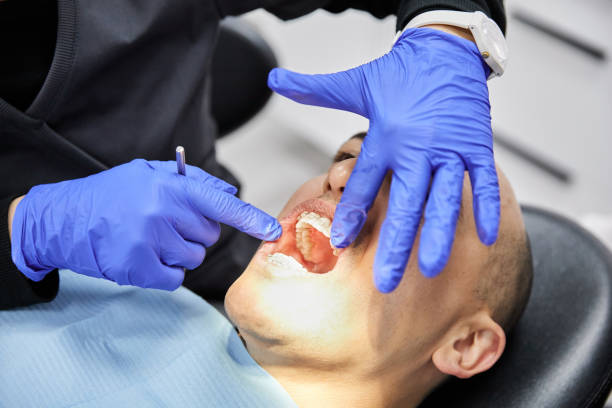 Best Dental Abscess Treatment in Hayden, AL